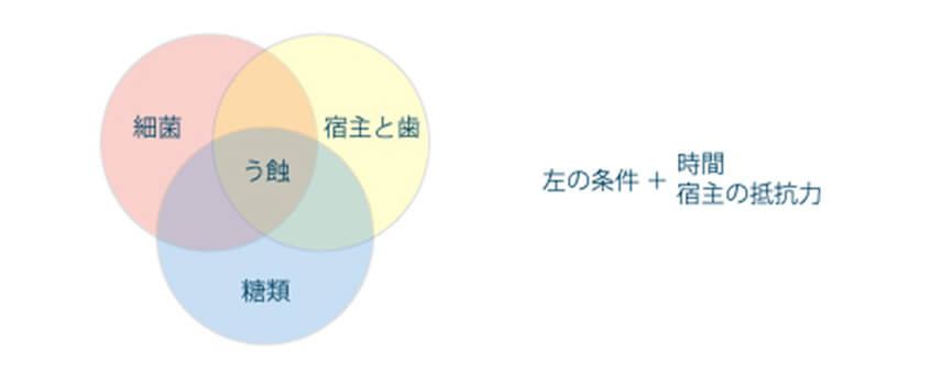 むし歯ってどうしてできるの？