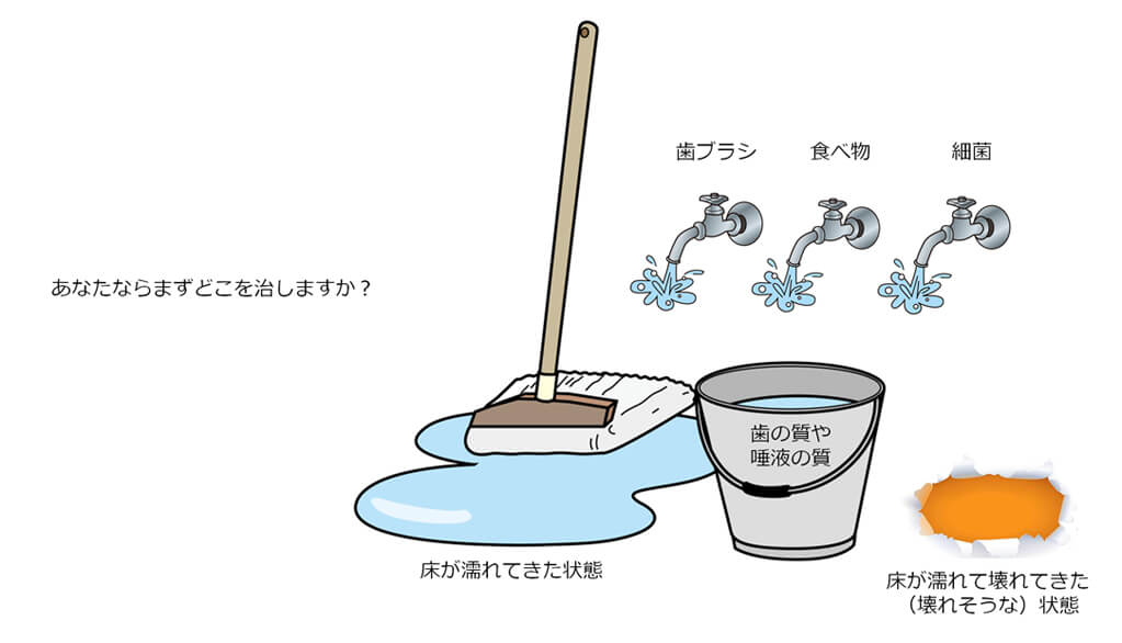 正しいむし歯の治療って?