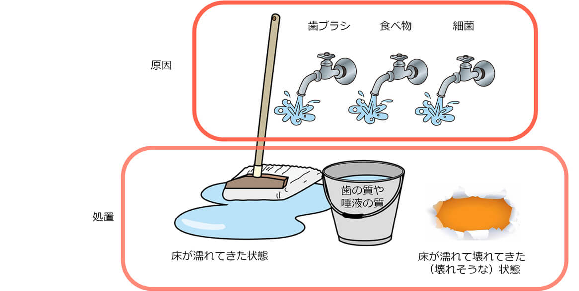 正しいむし歯の治療って？