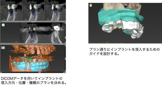 ④プランニング・3Dガイドデザイン
