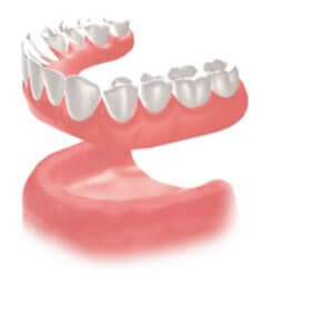 従来の治療方法 総入れ歯