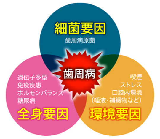 歯周病の進行度
