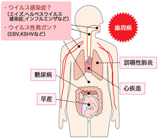 歯周病と全身疾患