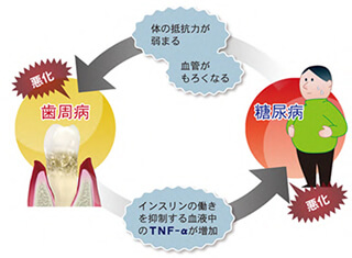 歯周病と糖尿病