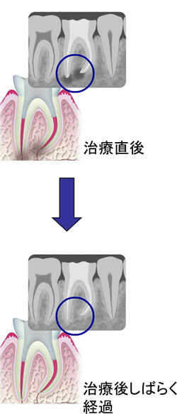 詰込んだものの確認にレントゲン写真を撮影